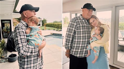 Model gets surgery because family said she looked like Bruce.